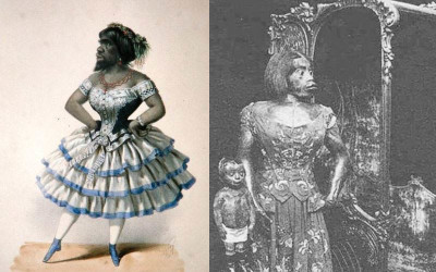 她被稱為「世上最醜女人」被馬戲團當「怪物」演出…死後150年屍體才被下葬