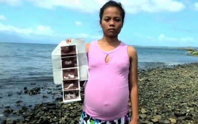 「海中異形讓她懷孕」女子照超音波發現腹中魚臉...一年後真相大白